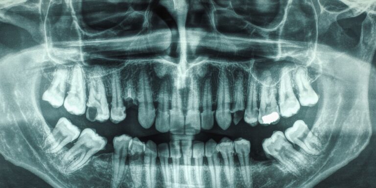 Dental X-ray Dallas, TX