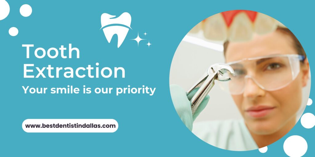 tooth extraction dallas